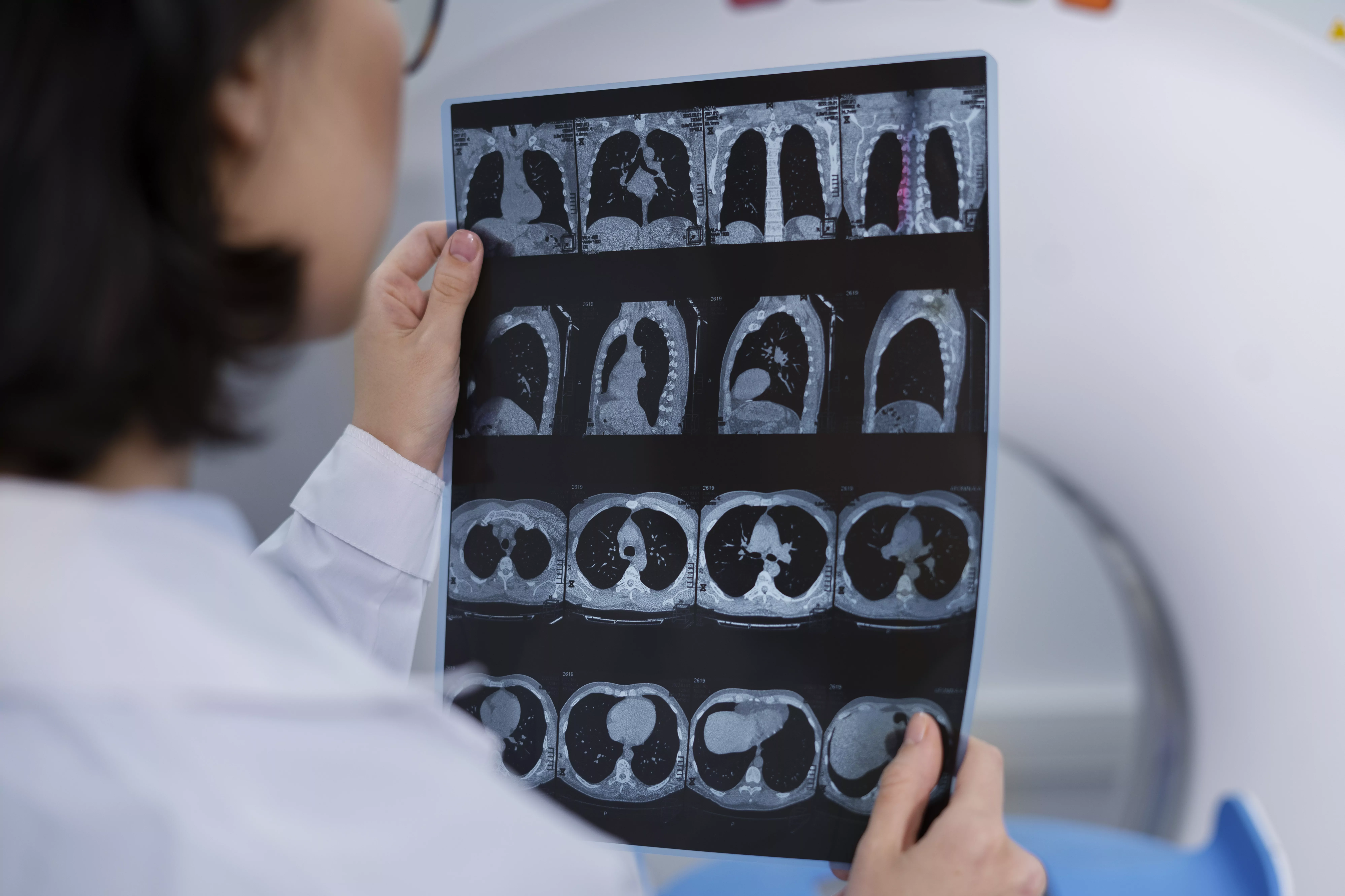 Densidad radiológica: cómo funciona y por qué es importante
