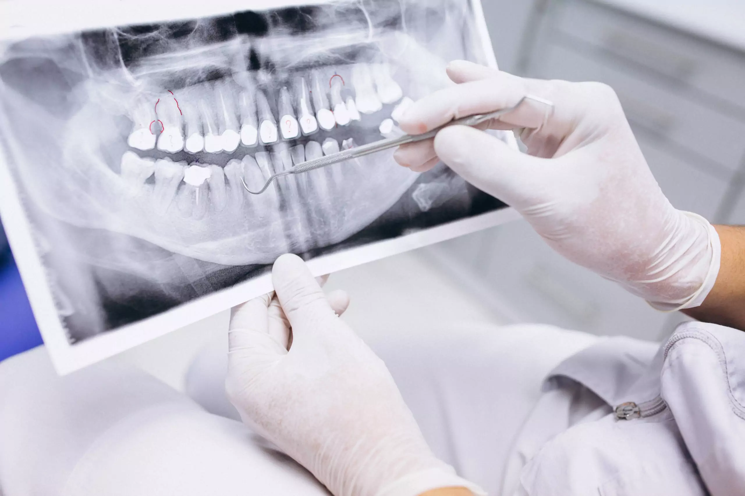 Síntomas bruxismo: Aprende a proteger tu salud dental
